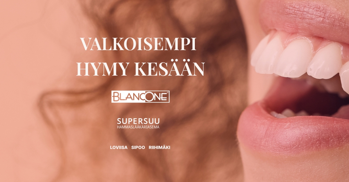supersuu -kesäkamppis (1290 x 1350 px) (Facebook-mainos)